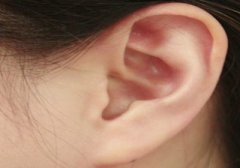 突发性耳聋是什么原因造成的？
